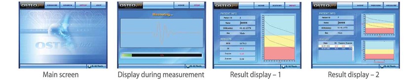 Main screen · Display during measurement · Result display 1 · Result display 2