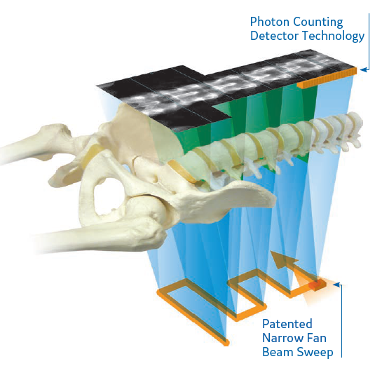 Photon Counting Detector · Patented Narrow Fan Beam Sweep