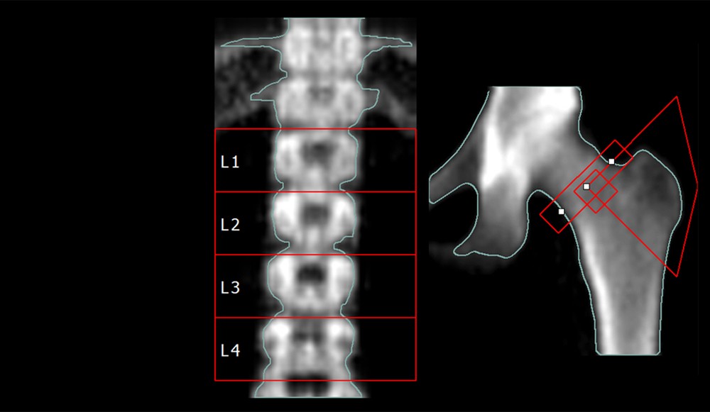 OSTEOPro MAX Pencil 스캔 결과